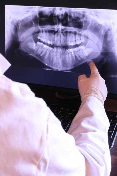 Best Emergency Dental Extractions in East Tawas, MI