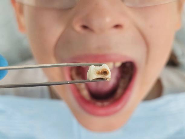Best Emergency Dental Services for Seniors in East Tawas, MI